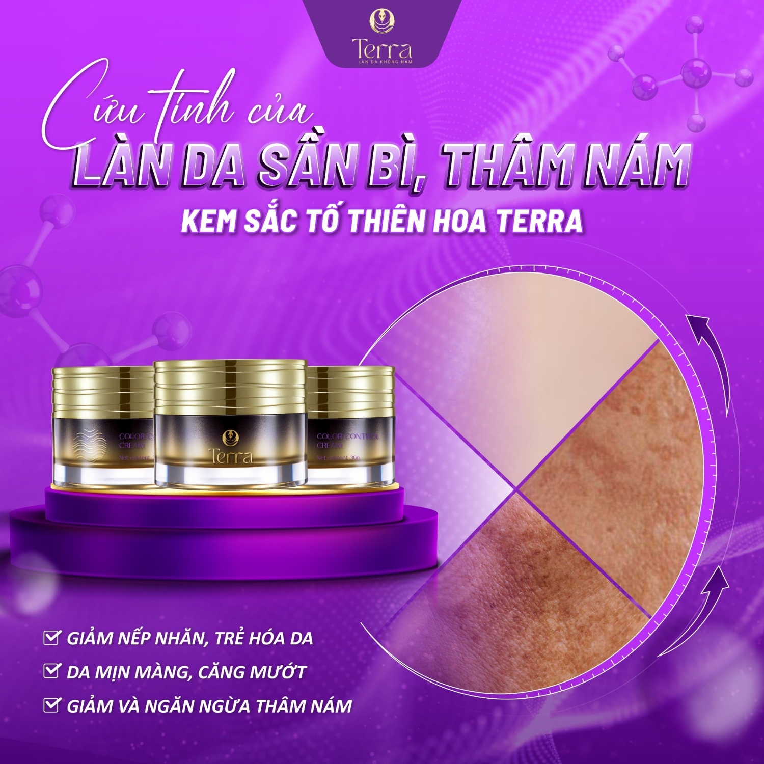 KEM THIEN HOA 1